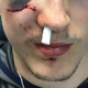 Illustration for article titled Zach Werenskis Face Is Really Fucked Up